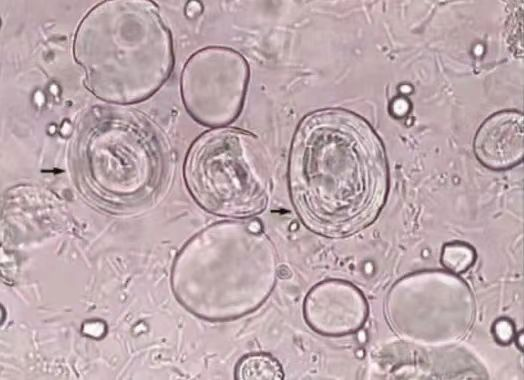 How to Identifying and differentiating starch granules?